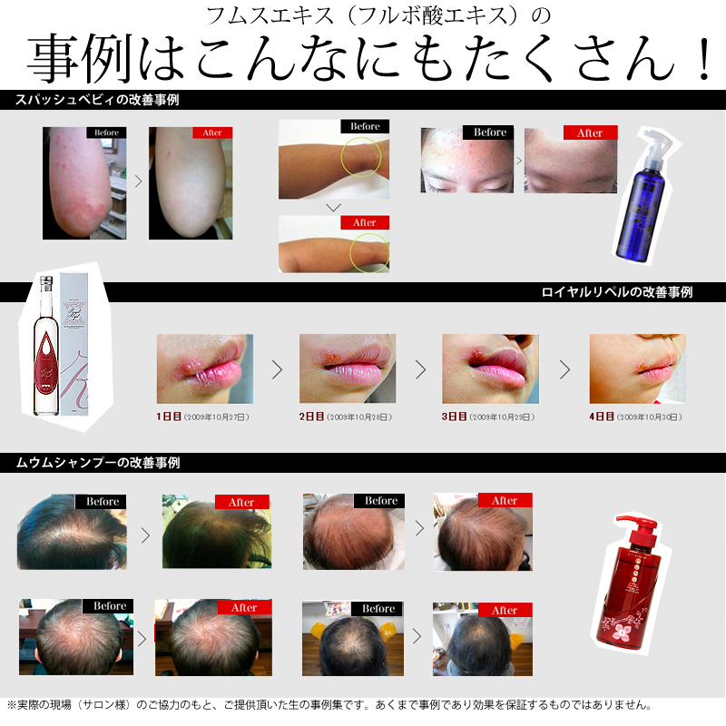 フルボ酸で効果を実感した人は沢山【ムウム】